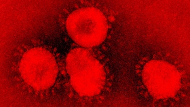 Los científicos consideran al coronavirus una sindemia: ¿Cuál es la  diferencia con una pandemia? | MARCA Claro Argentina